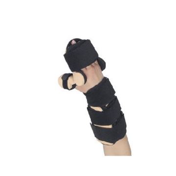  Splints